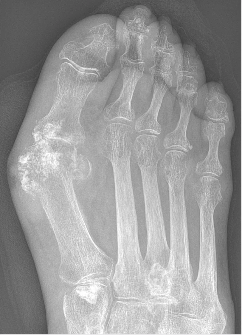 Bone & joint disease radiograph for self-assessment