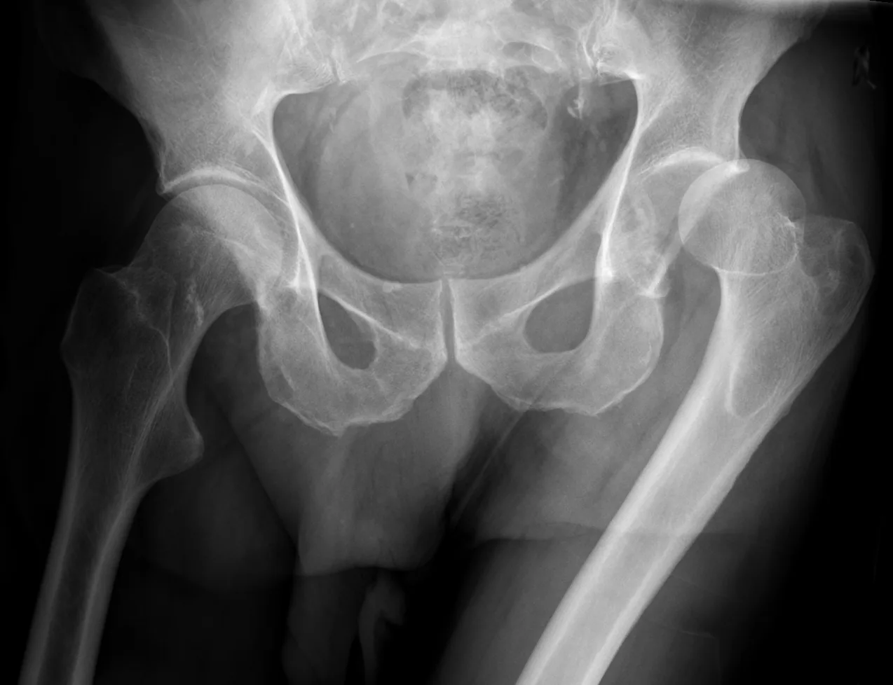 Lower limb radiograph for self-assessment