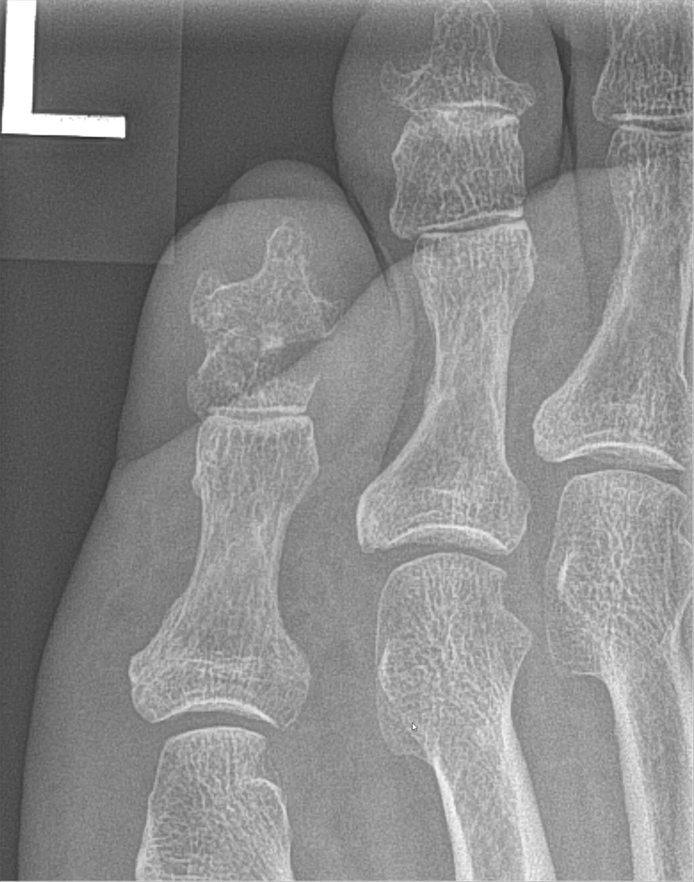 Bone & joint disease radiograph for self-assessment