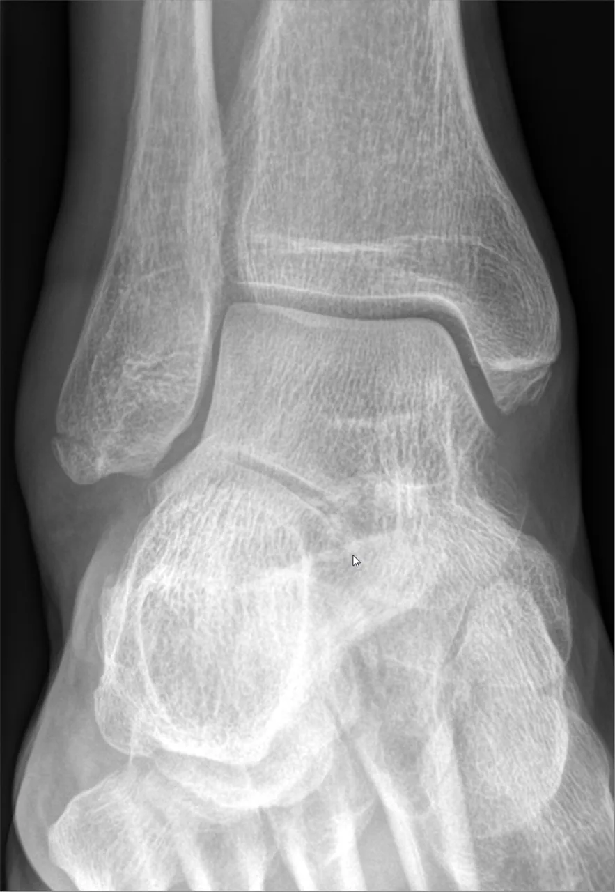 Lower limb radiograph for self-assessment