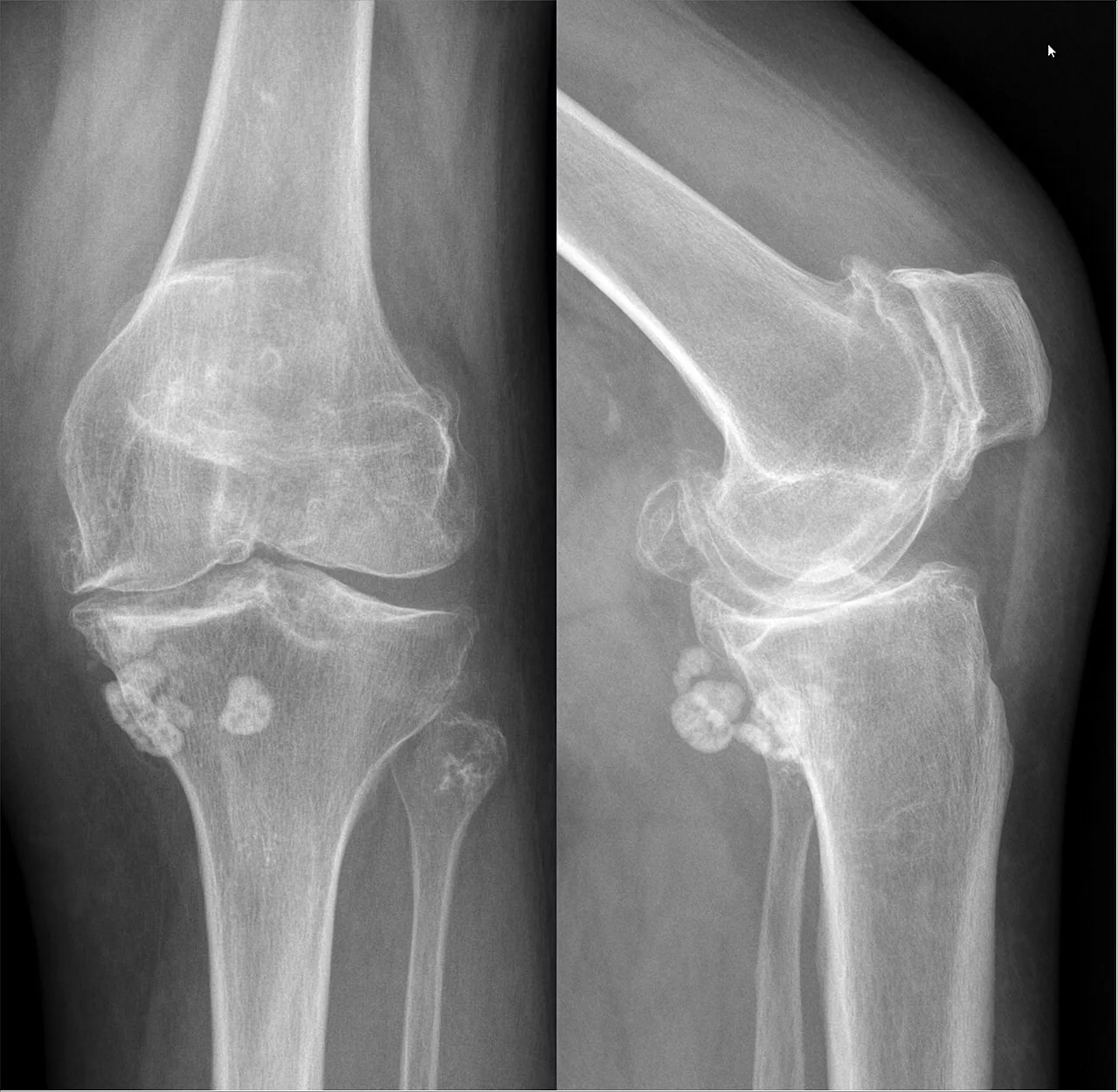 Bone & joint disease radiograph for self-assessment