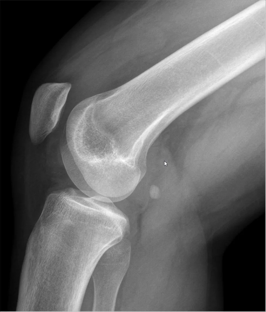 Lower limb radiograph for self-assessment