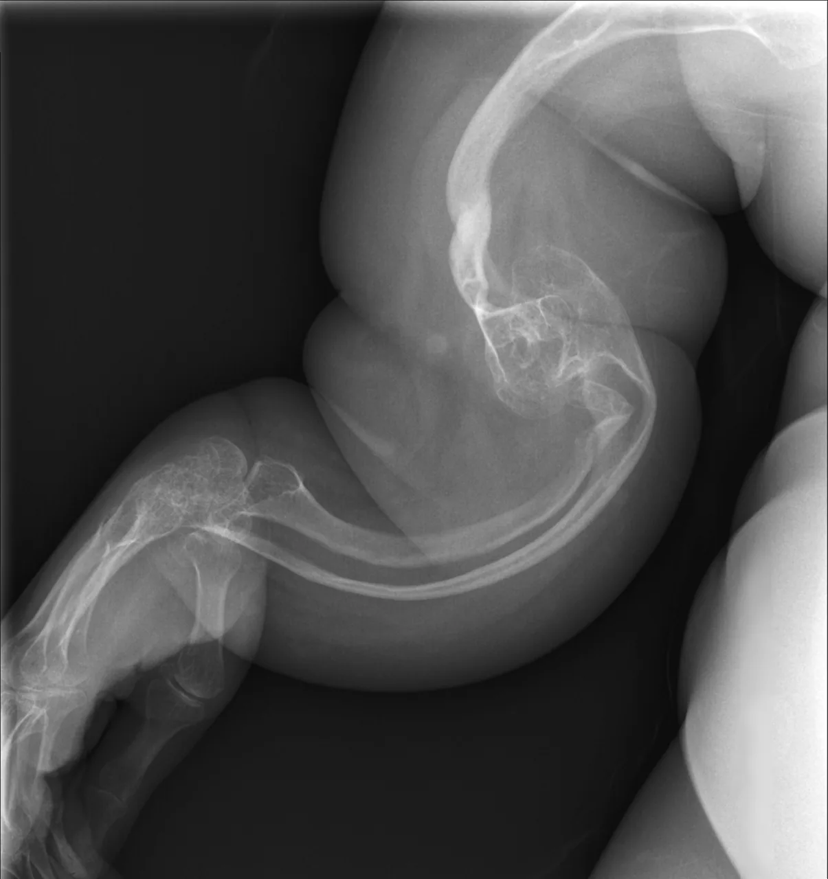 Paediatric radiograph for self-assessment