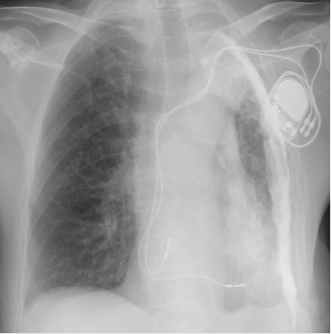 Chest radiograph for self-assessment