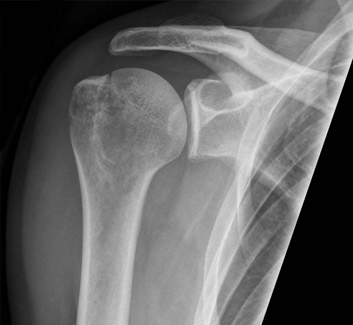Upper limb radiograph for self-assessment