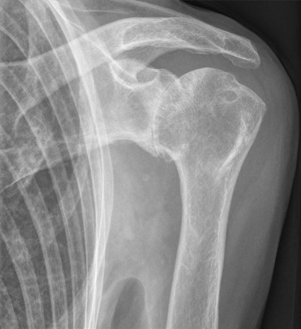 Bone & joint disease radiograph for self-assessment