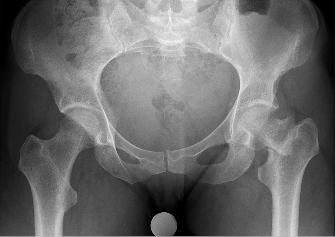 Lower limb radiograph for self-assessment