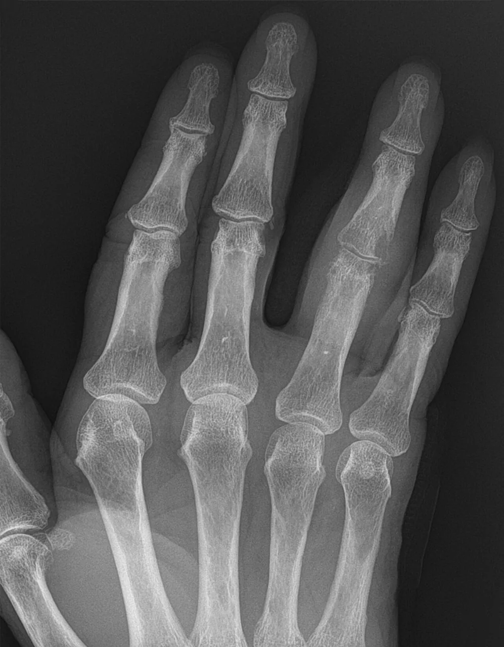 Bone & joint disease radiograph for self-assessment