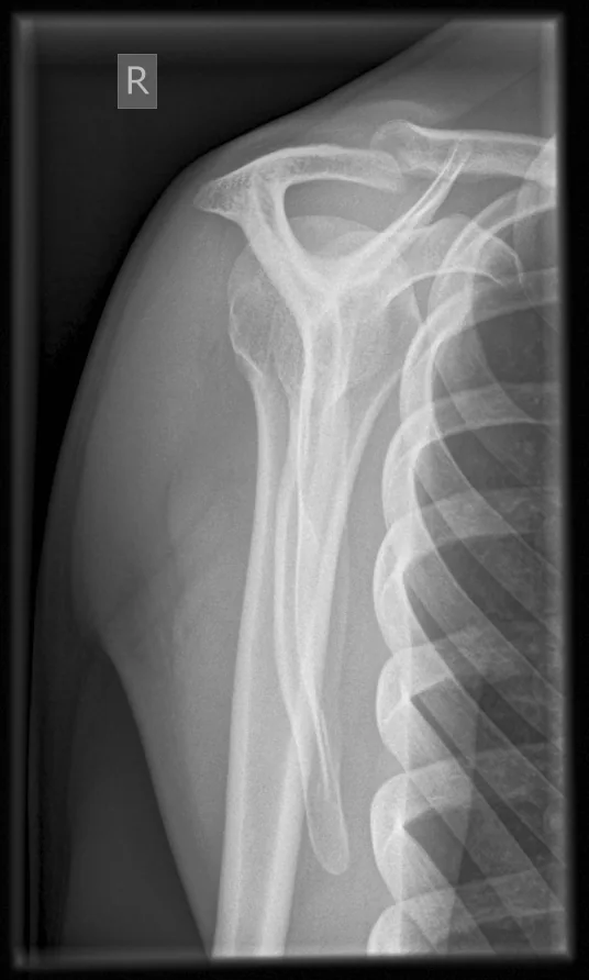 Upper limb radiograph for self-assessment