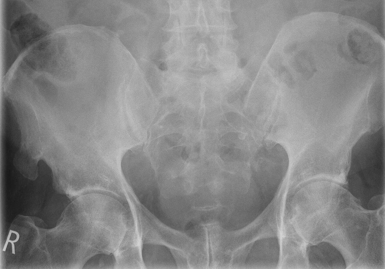 Bone & joint disease radiograph for self-assessment