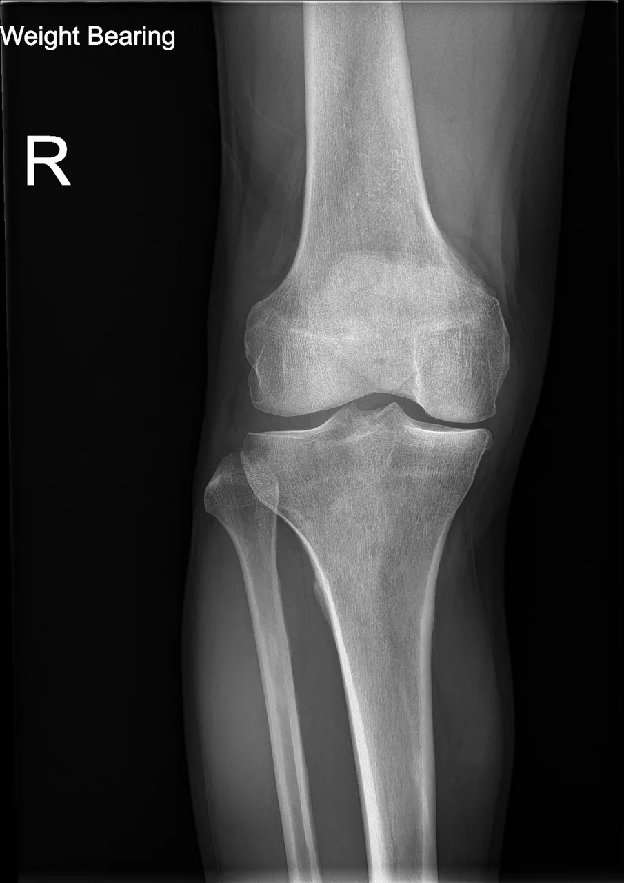 Bone & joint disease radiograph for self-assessment
