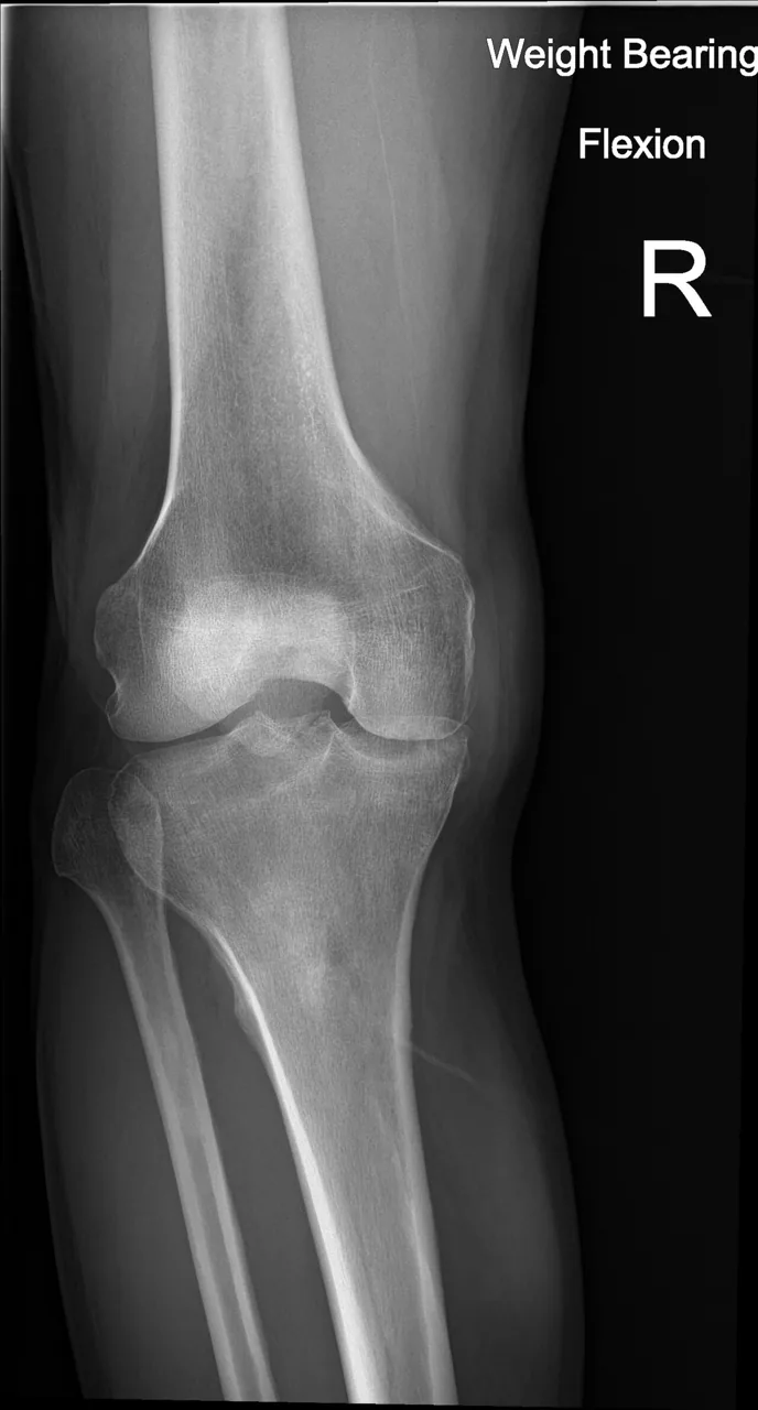 Bone & joint disease radiograph for self-assessment
