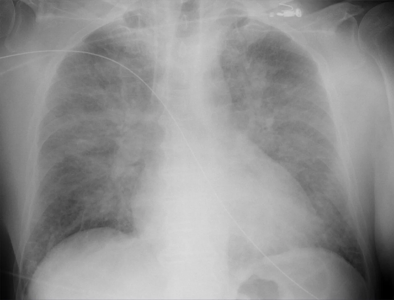 Chest radiograph for self-assessment