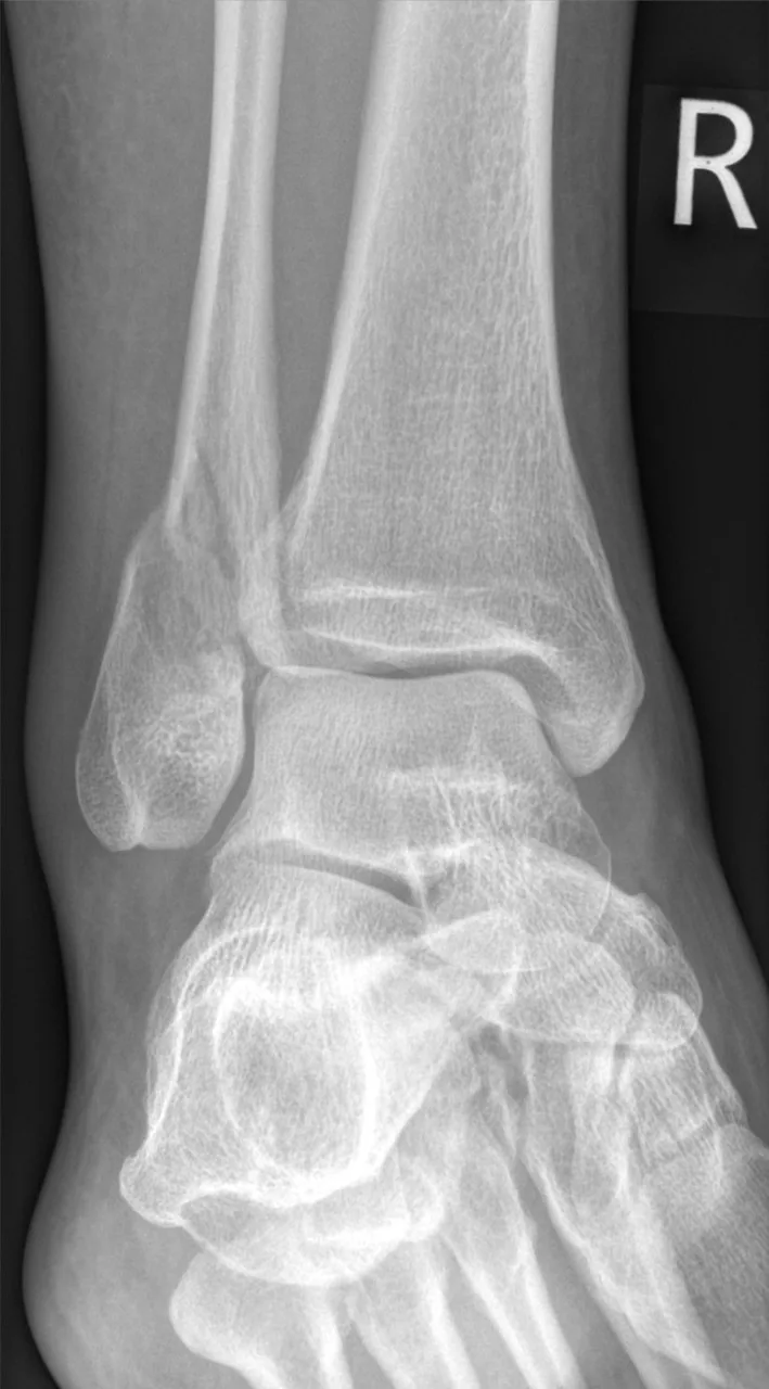 Lower limb radiograph for self-assessment