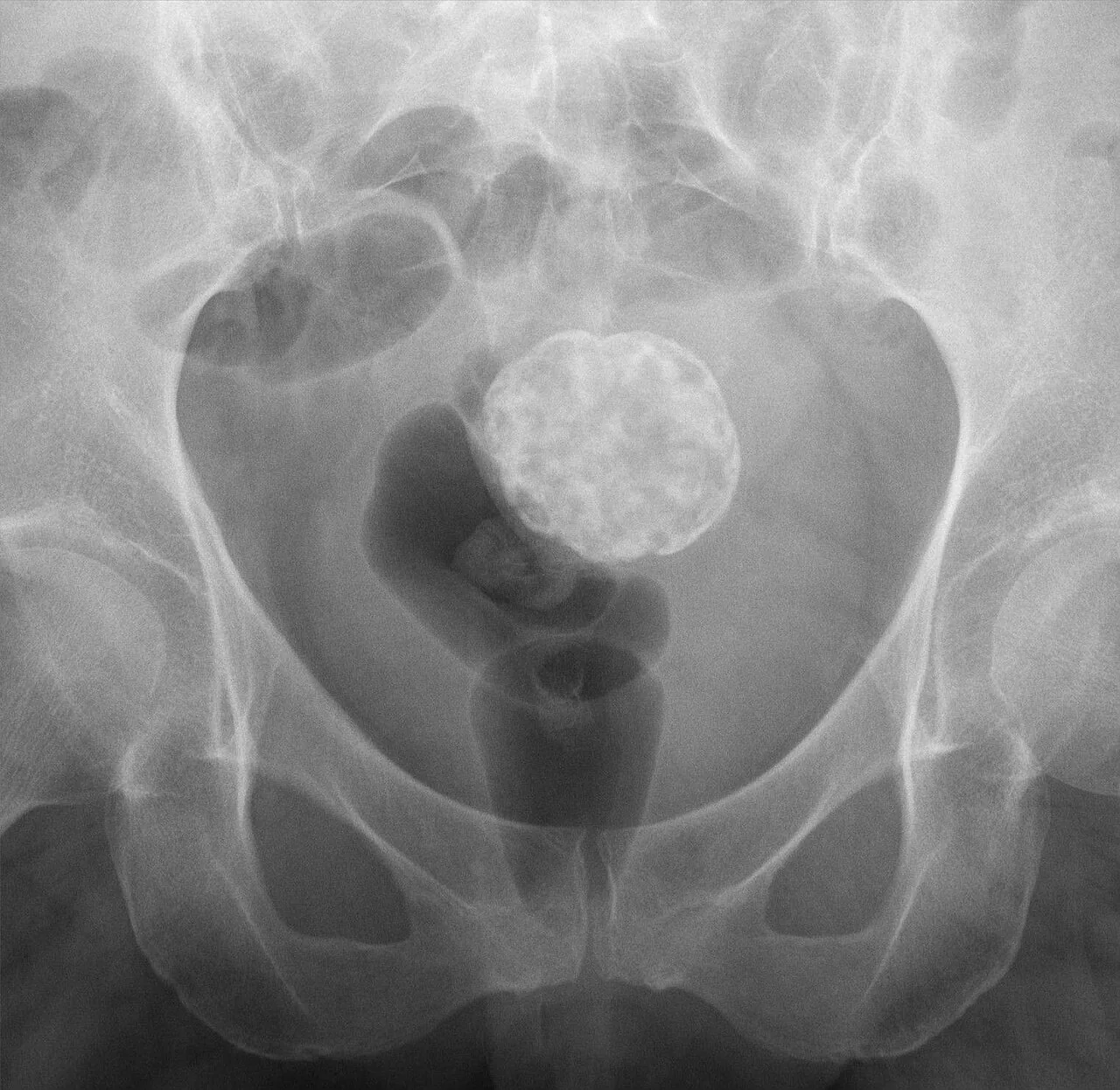 Abdomen radiograph for self-assessment