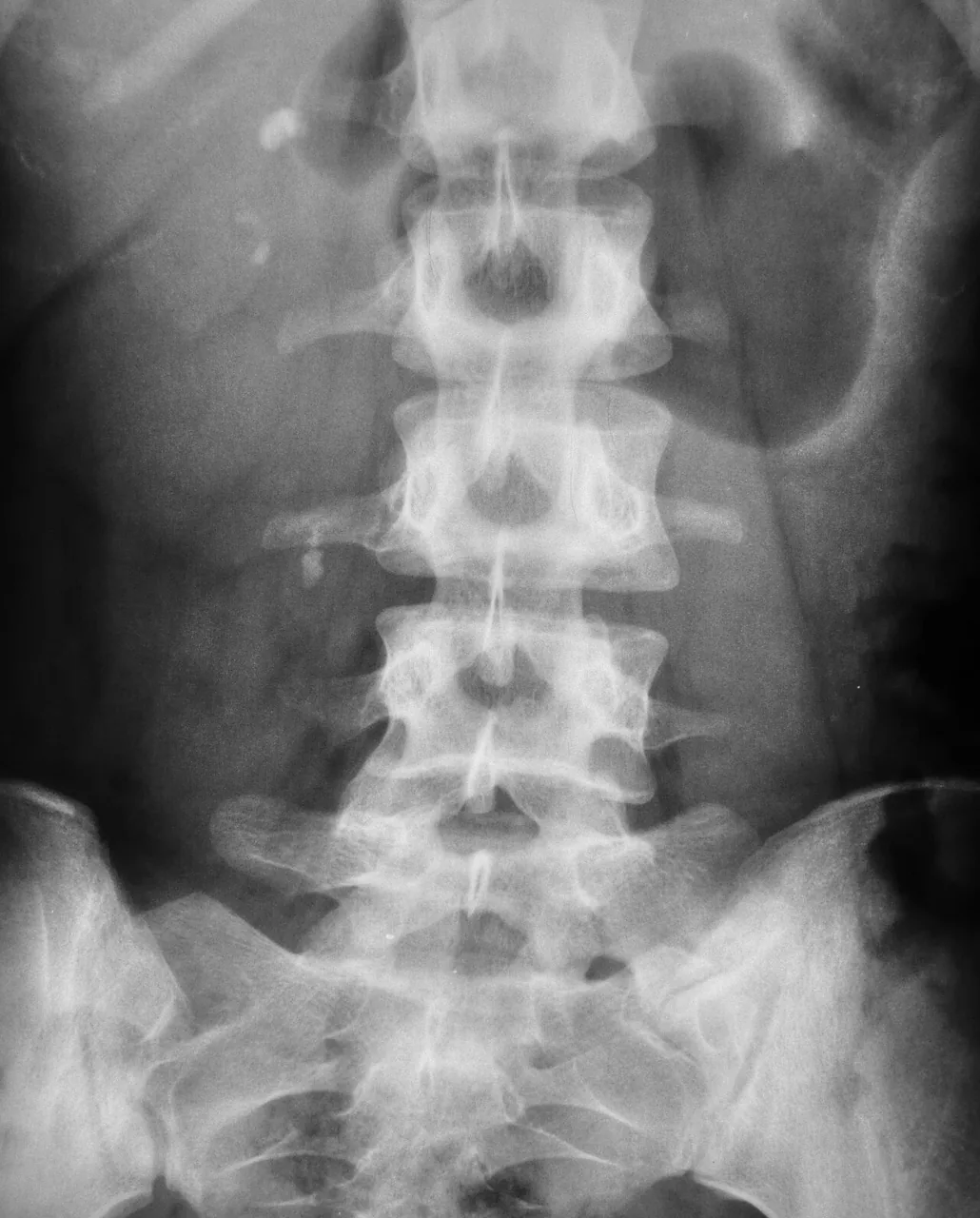 Abdomen radiograph for self-assessment