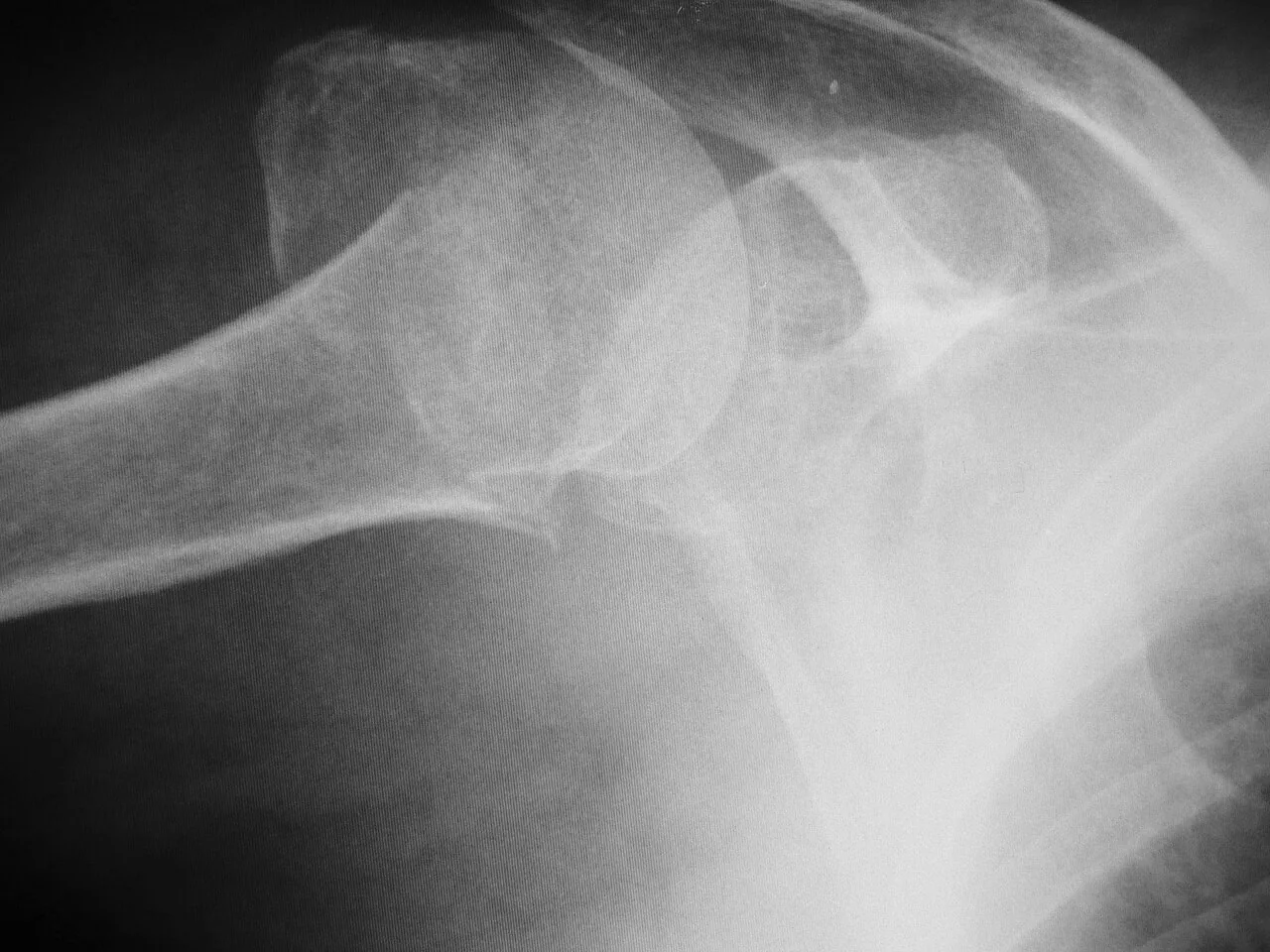 Upper limb radiograph for self-assessment