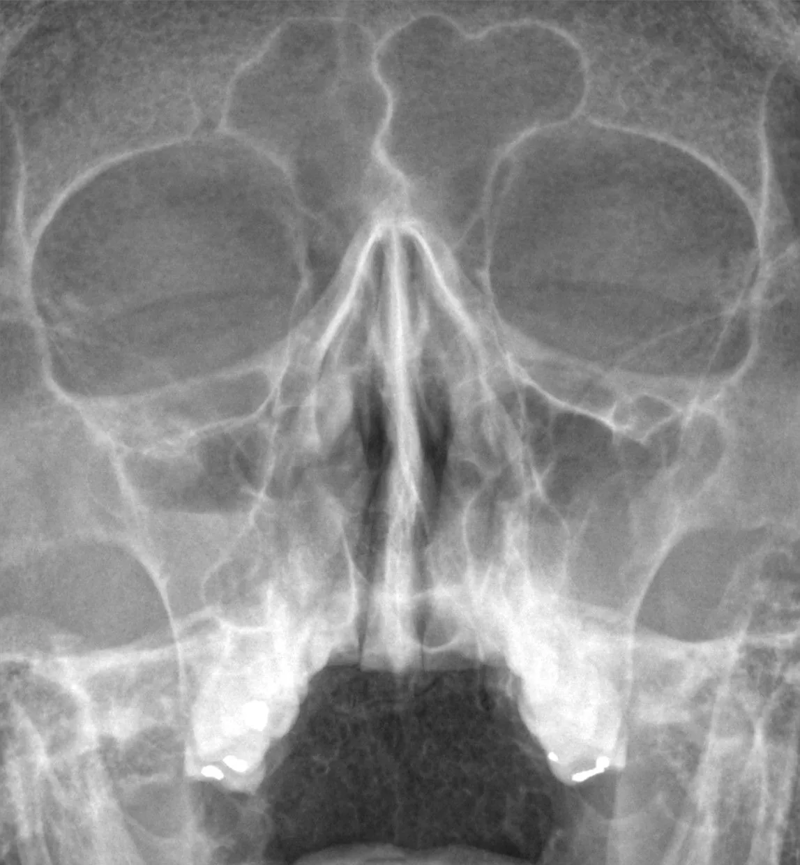 Skull & face radiograph for self-assessment