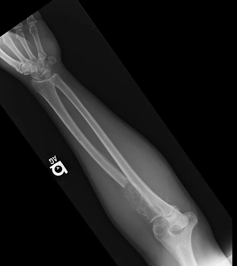 Bone & joint disease radiograph for self-assessment