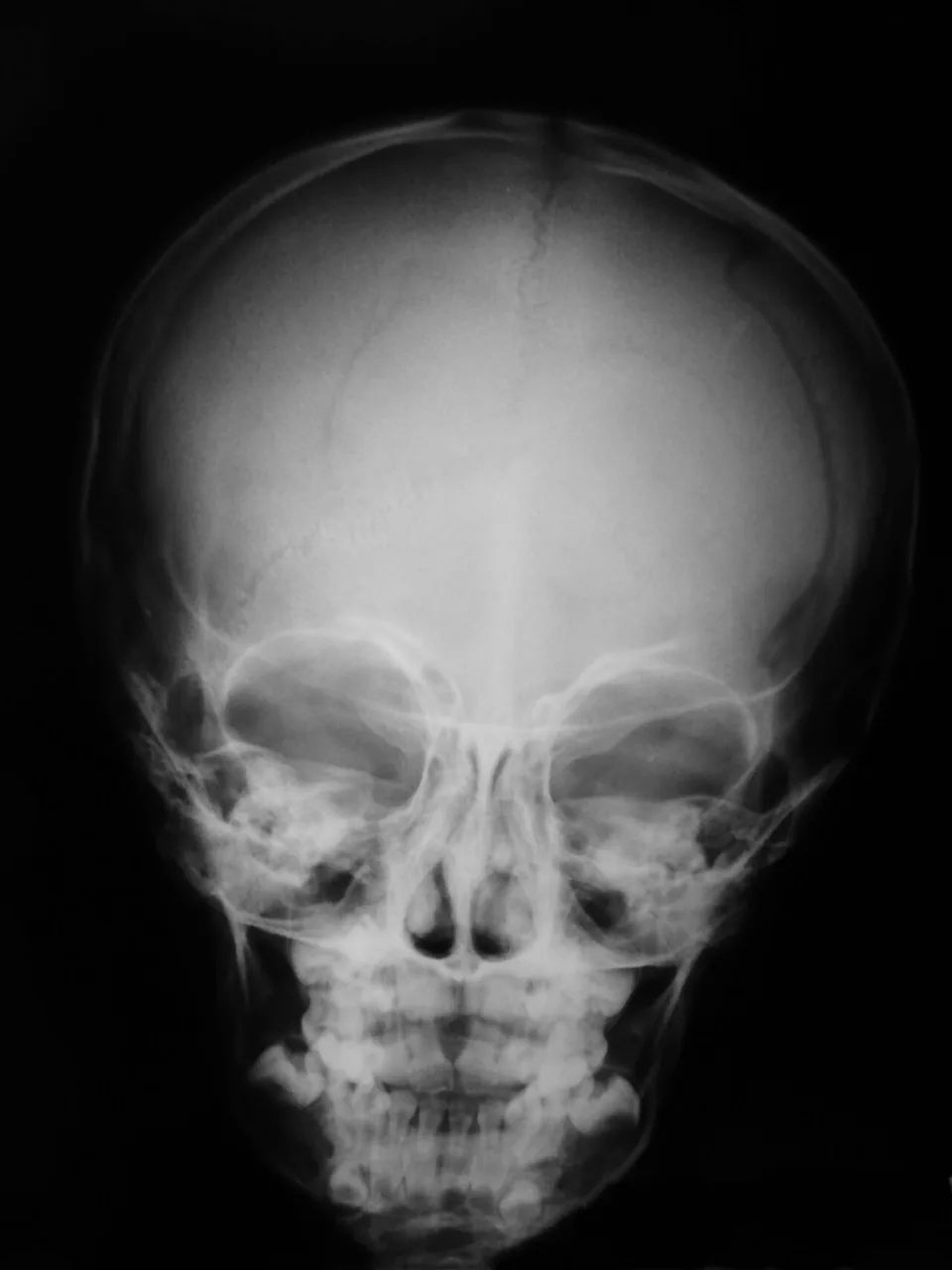 Skull & face radiograph for self-assessment