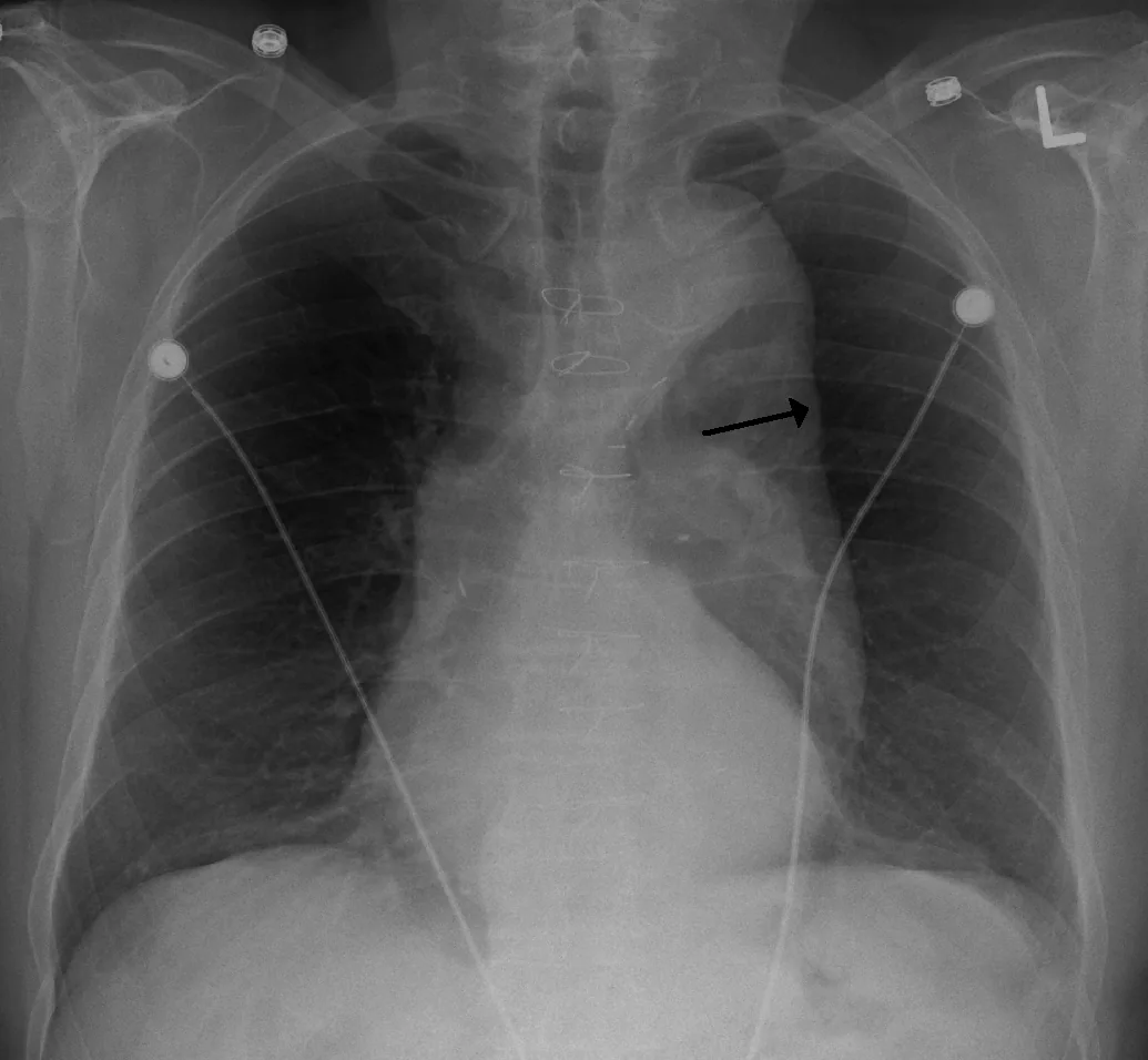 Chest radiograph for self-assessment