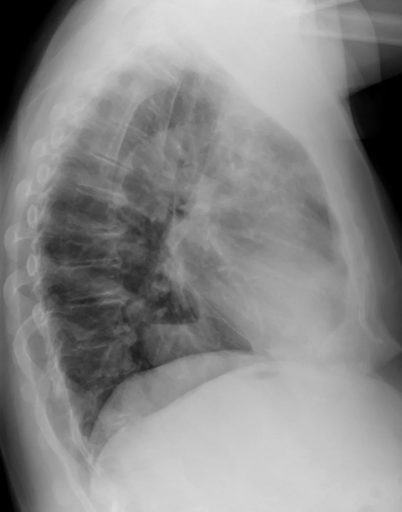 Chest radiograph for self-assessment