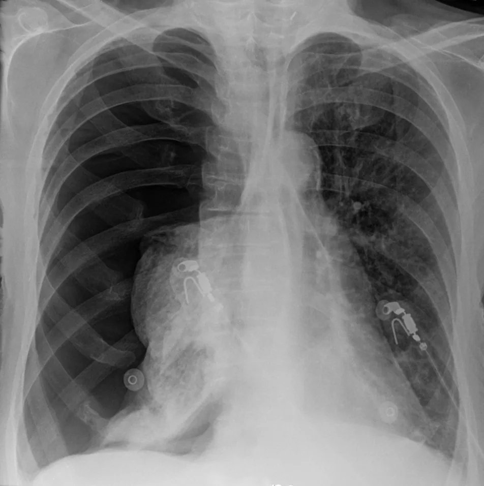 Chest radiograph for self-assessment