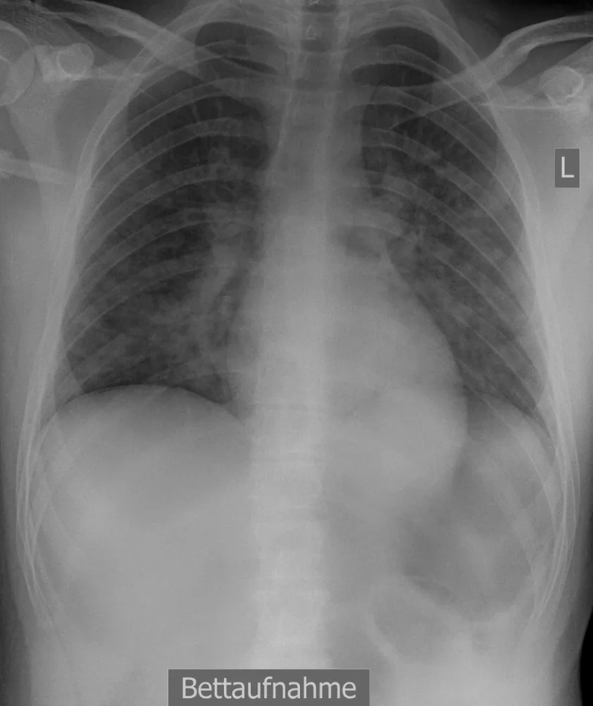 Chest radiograph for self-assessment