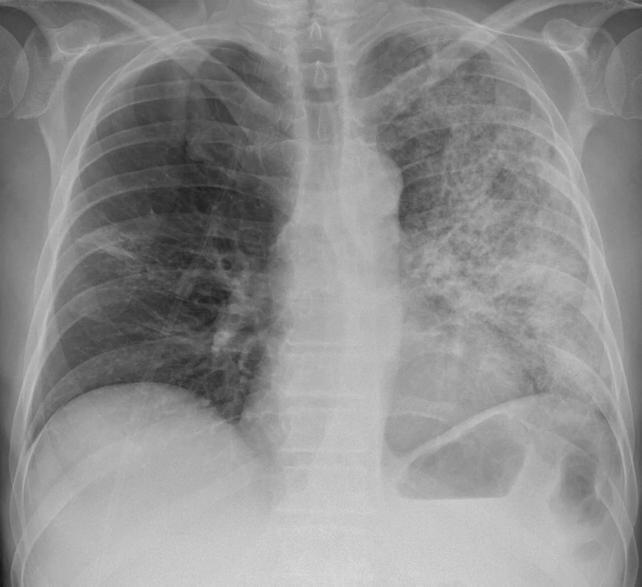 Chest radiograph for self-assessment