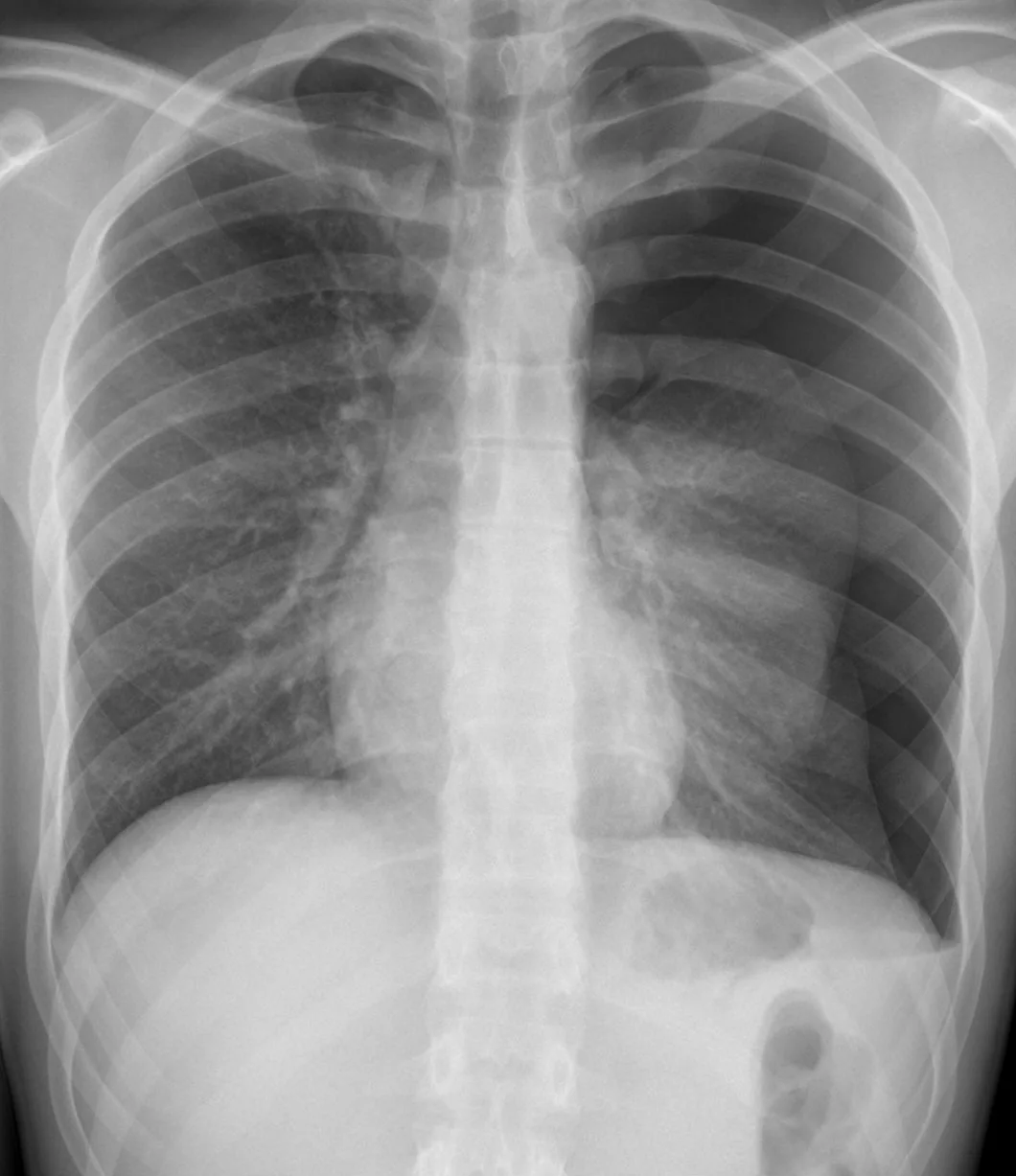 Practice radiograph