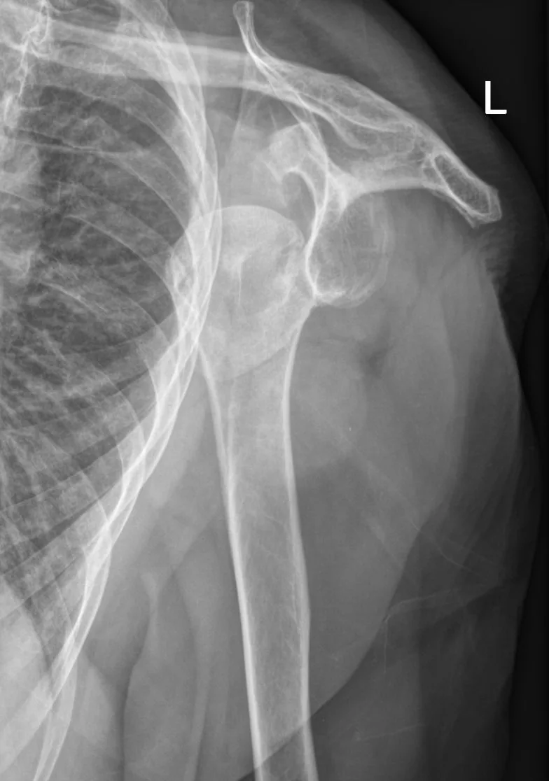 Upper limb radiograph for self-assessment