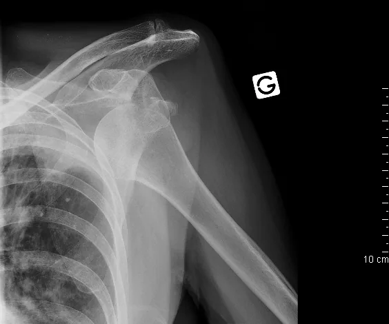 Upper limb radiograph for self-assessment