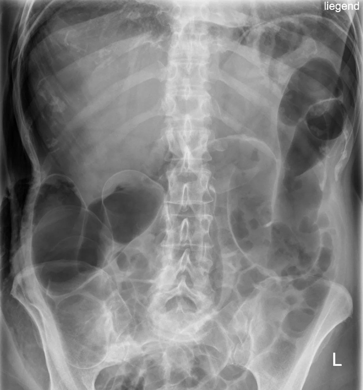 Abdomen radiograph for self-assessment
