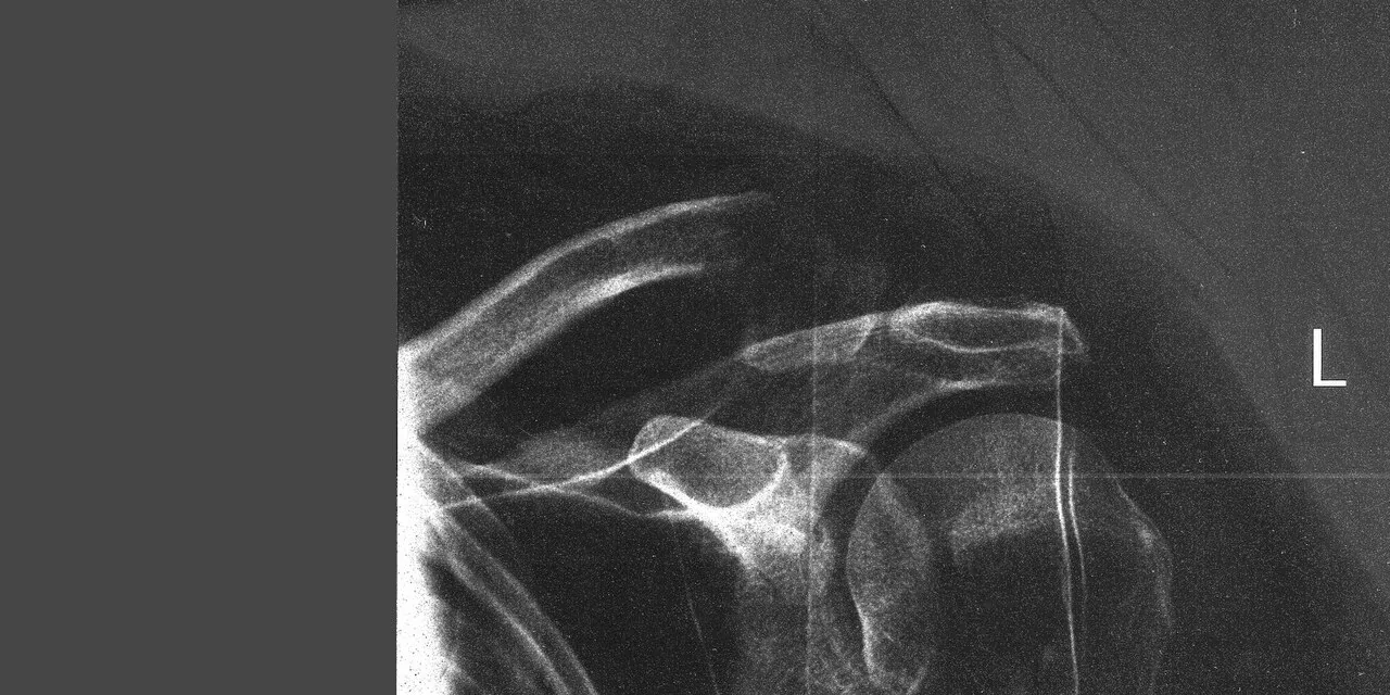 Upper limb radiograph for self-assessment