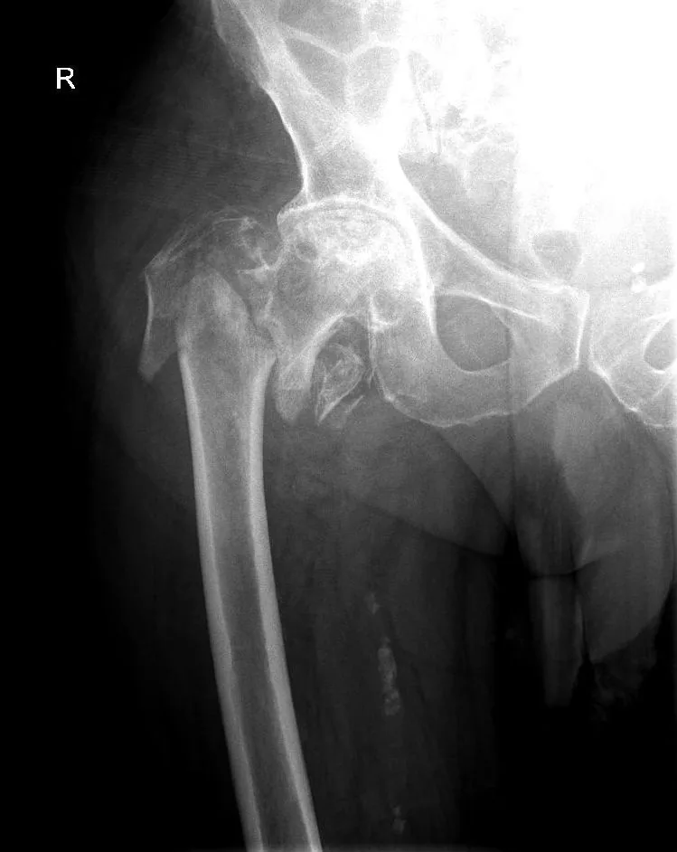 Lower limb radiograph for self-assessment