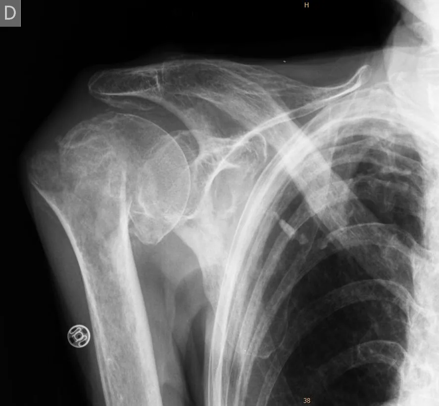 Upper limb radiograph for self-assessment