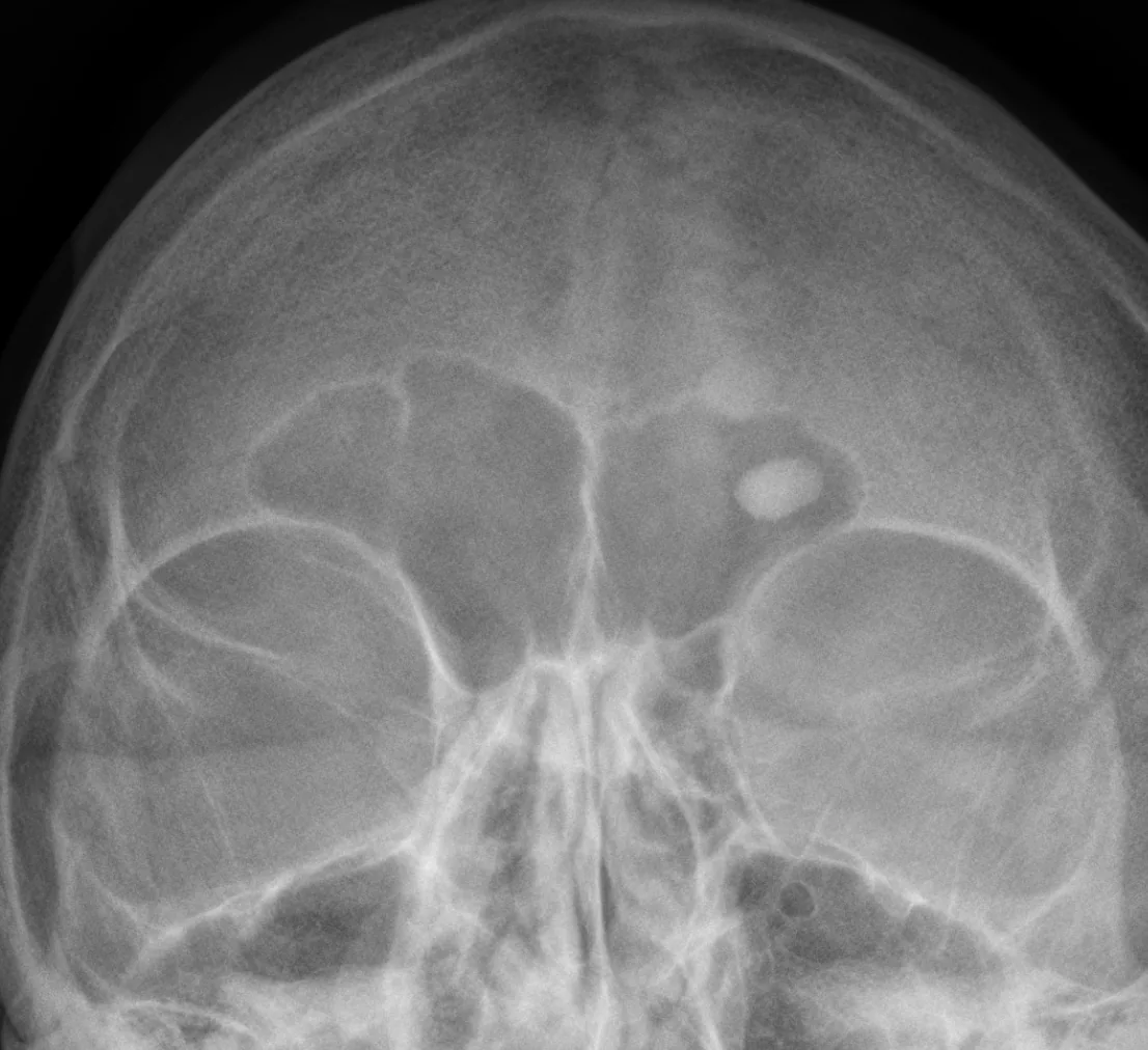 Bone & joint disease radiograph for self-assessment