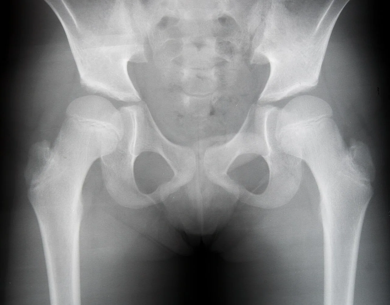 Paediatric radiograph for self-assessment