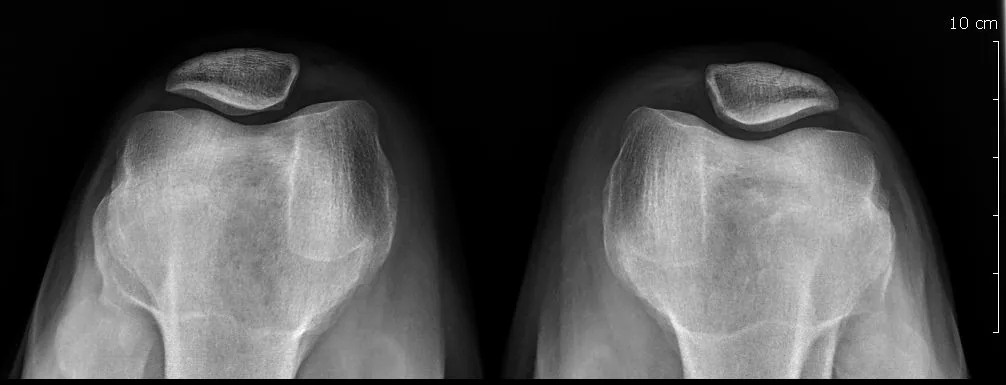 Lower limb radiograph for self-assessment