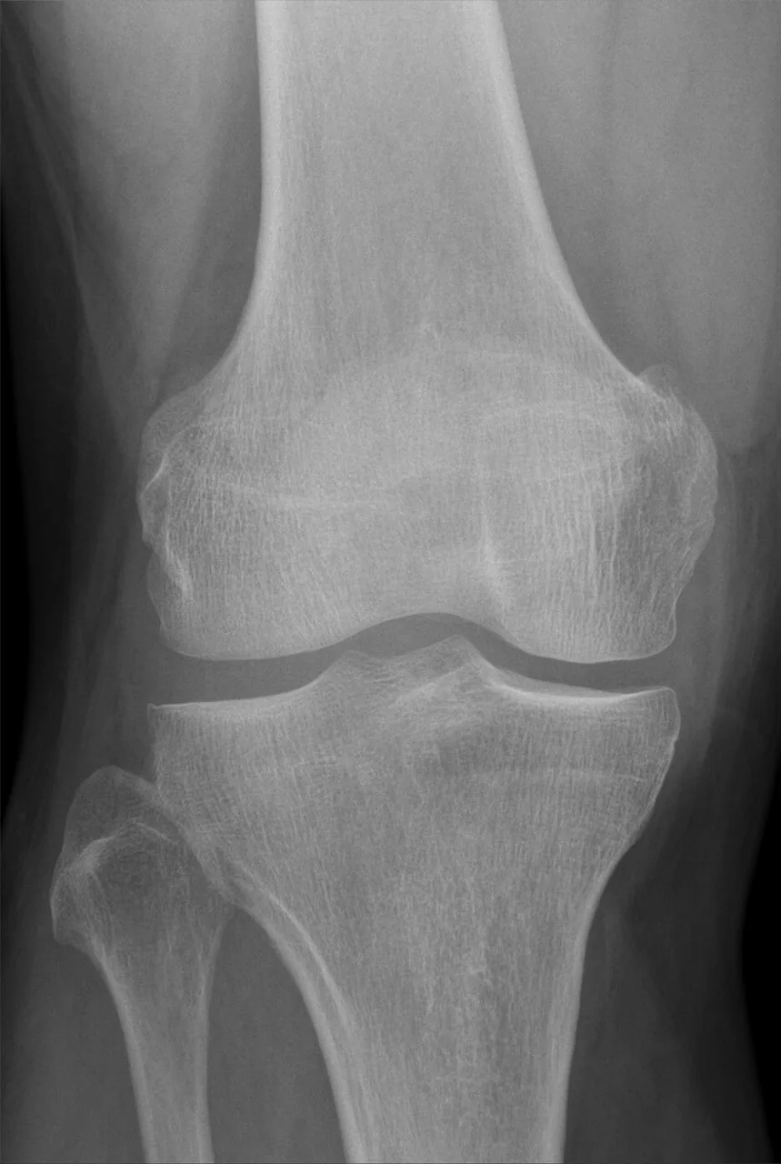 Lower limb radiograph for self-assessment