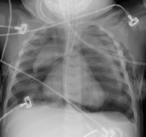 Chest radiograph for self-assessment