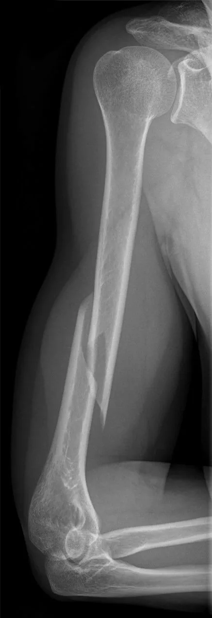 Upper limb radiograph for self-assessment