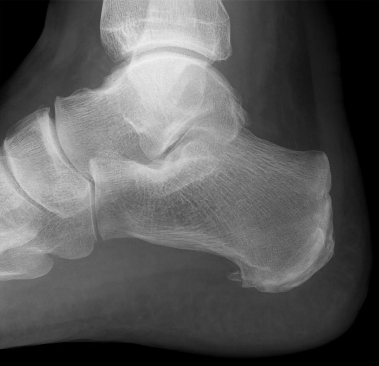 Lower limb radiograph for self-assessment