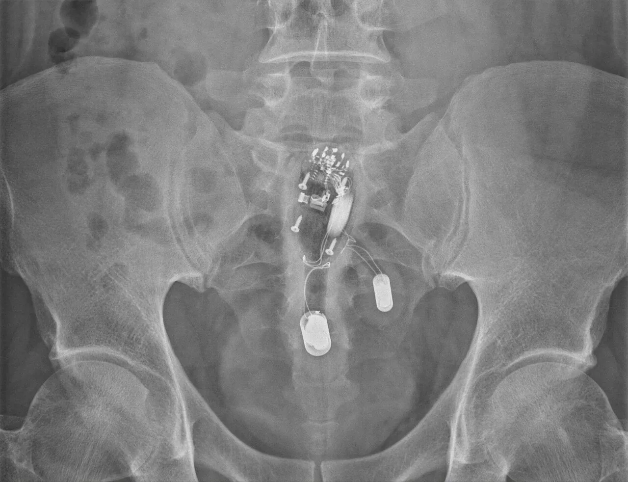Abdomen radiograph for self-assessment