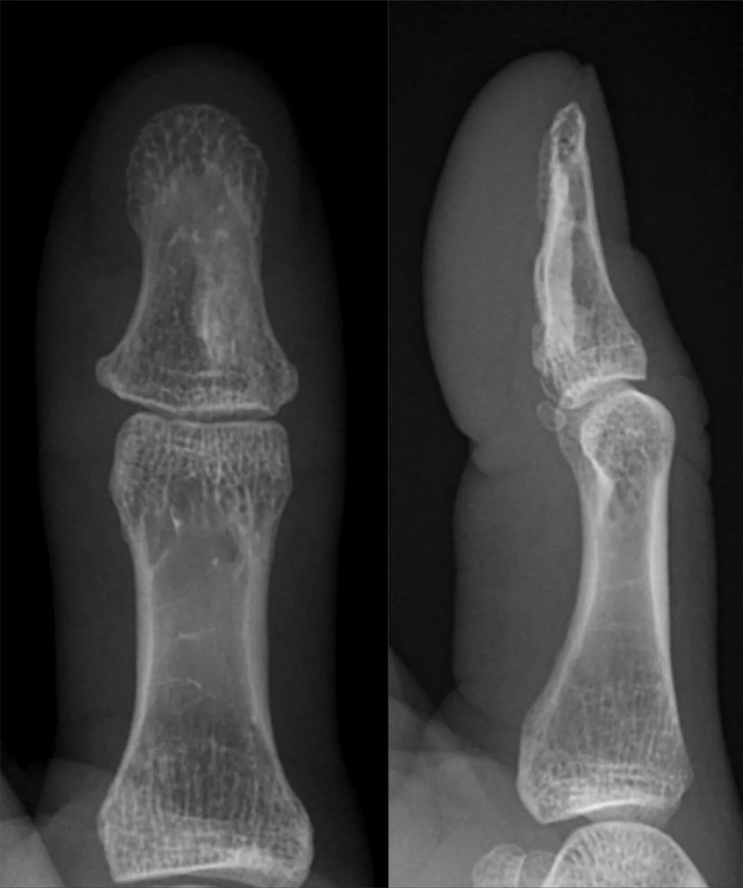 Bone & joint disease radiograph for self-assessment
