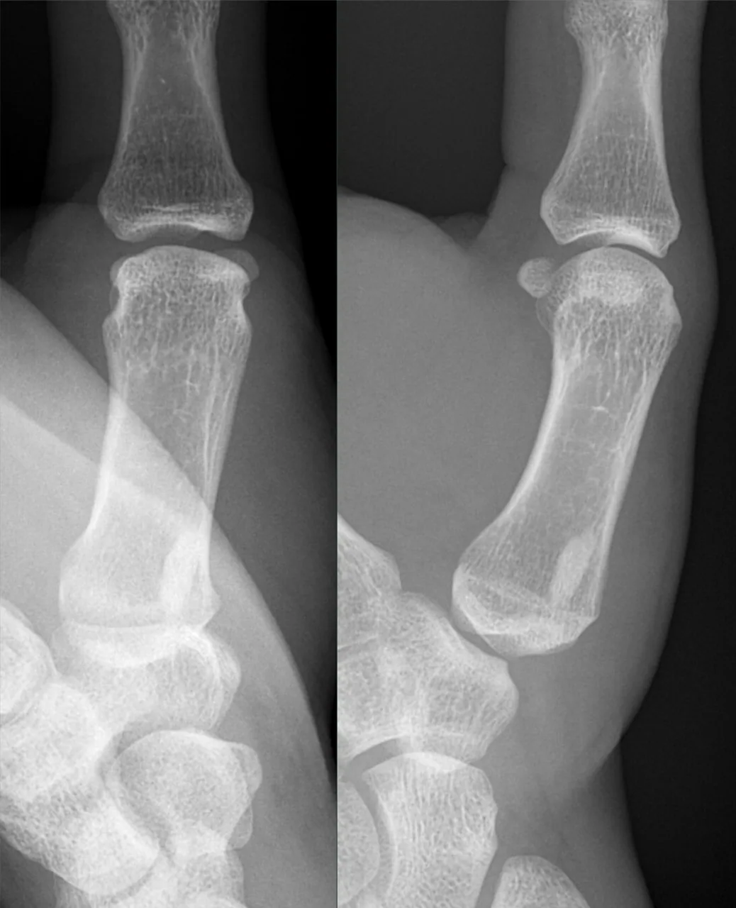 Bone & joint disease radiograph for self-assessment