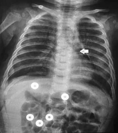 Chest radiograph for self-assessment