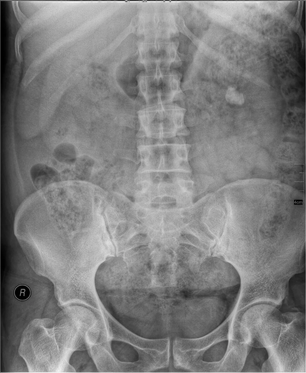 Abdomen radiograph for self-assessment