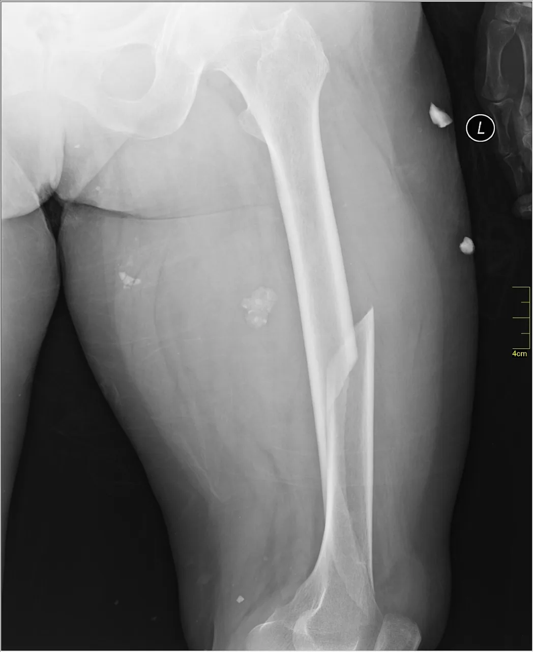 Lower limb radiograph for self-assessment