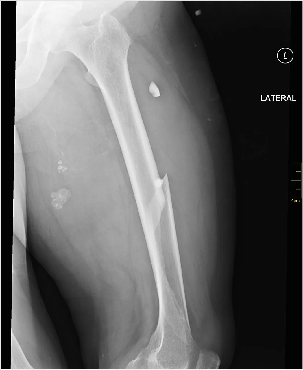 Lower limb radiograph for self-assessment
